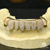 Grillz Custom en Or | Grillz Grillz 8 Dents Diamant PermaCut - Yellow