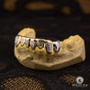 Grillz Custom en Or | Grillz Grillz 8 Dents Diamond Cut